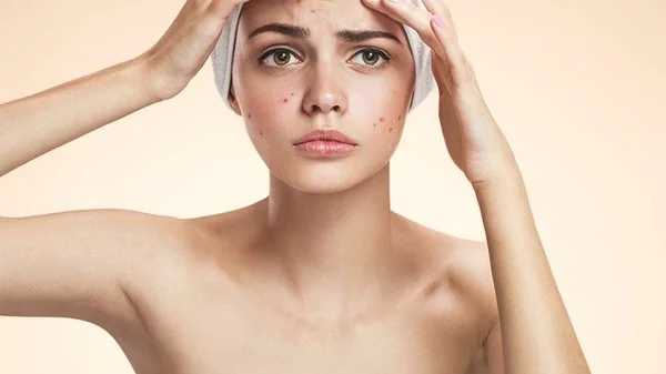 冬季皮肤保健保湿最重要,防燥防寒保护皮肤
