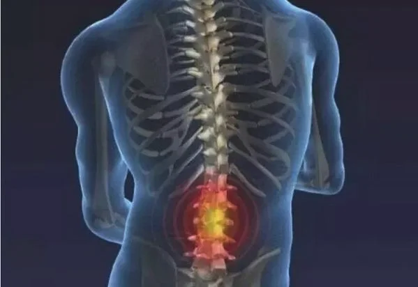 检查腰椎是否健康要检查哪些方面