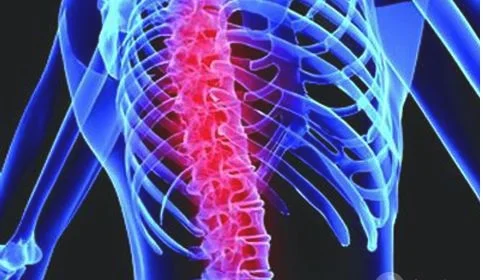 人体中关于脊柱方面的疾病有哪些