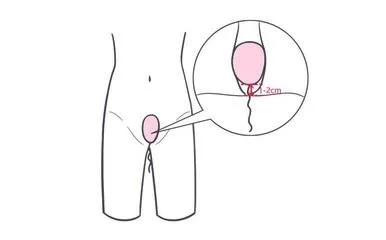 女性阴道瘙痒不止可能暗示四种疾病