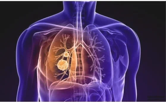 肺部功能的监测分别监测哪些方面