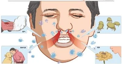 中医方法治疗过敏性鼻炎有哪些窍门