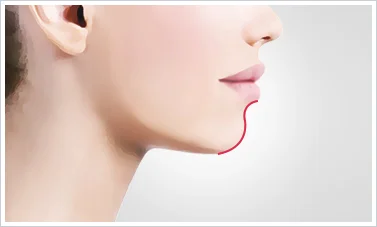 下巴部位脂肪多的原因和改善方法