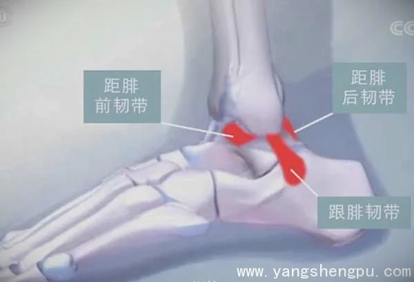 踝关节扭伤,习惯性崴脚20200228健康之路