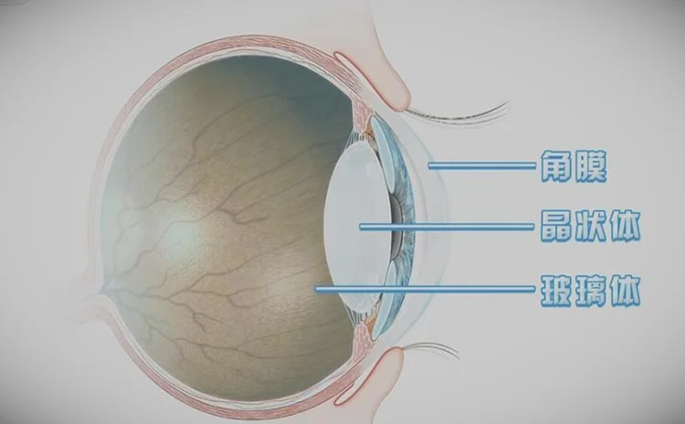 健康之路:白内障手术有什么风险,青光眼,失明20220112