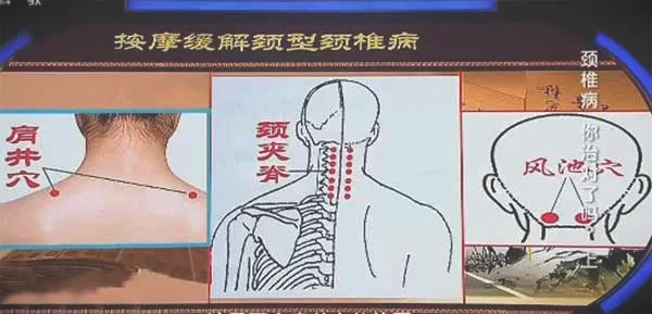 颈夹脊穴的准确位置图-颈夹脊的作用