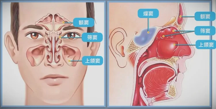 鼻窦的位置图-鼻窦的结构图解