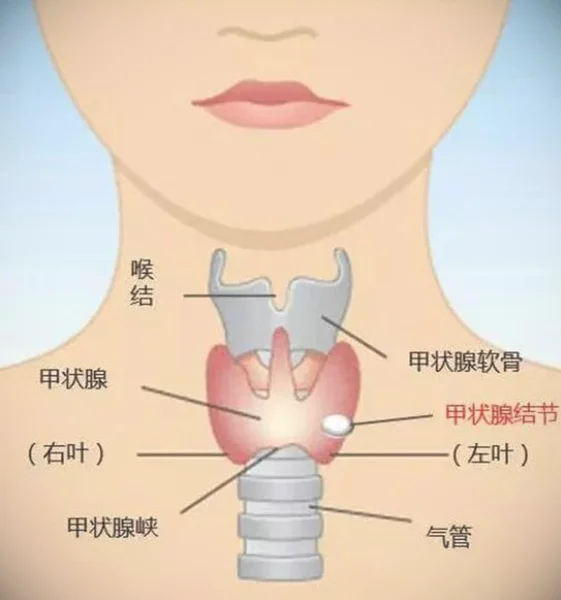 甲状腺的位置及周围结构_图片
