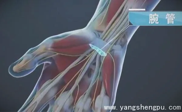 腕管结构和位置图_腕管综合征