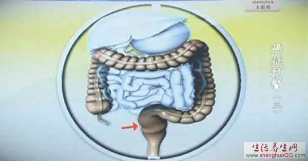 大肠的结构图
