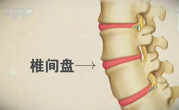 腰椎间盘突出-椎间盘的结构
