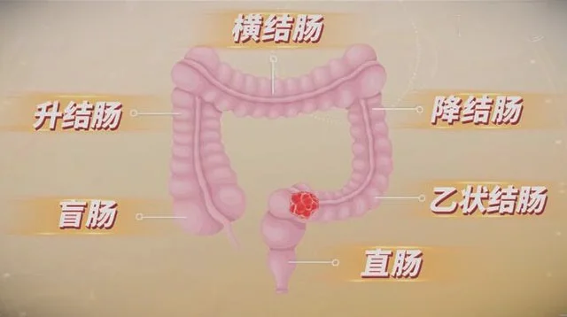大肠分为哪几部分-大肠各段的名称_图片