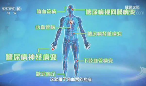 健康之路20180930母义明,刘英华,糖尿病控制及并发症