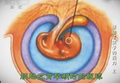 胚胎时期的眼睛发育