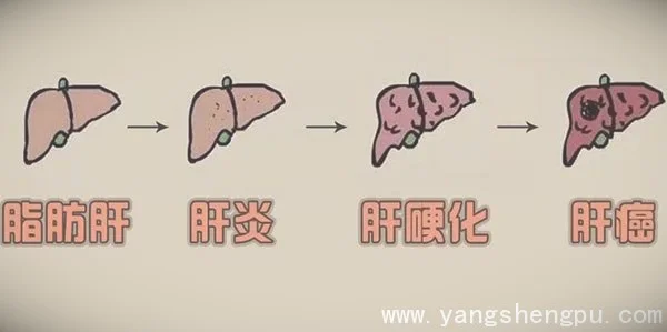 脂肪肝发展成肝癌_图片