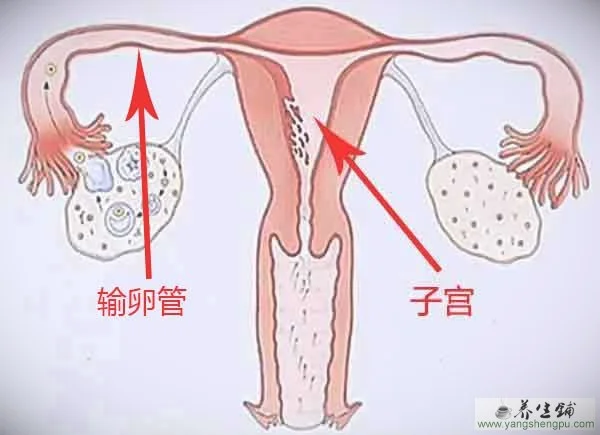 宫外孕-什么是宫外孕-宫外孕的症状和原因