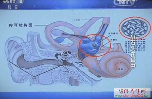 耳石症发生位置_内耳结构