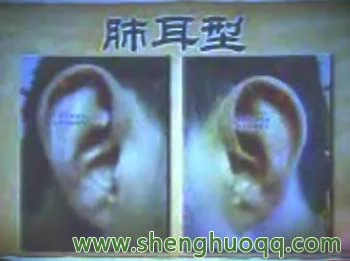 肺型耳