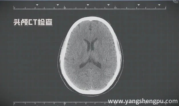 头颅CT检查-头颅ct解剖图_图片