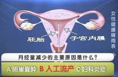 月经量过少,多囊卵巢综合征20140521健康之路