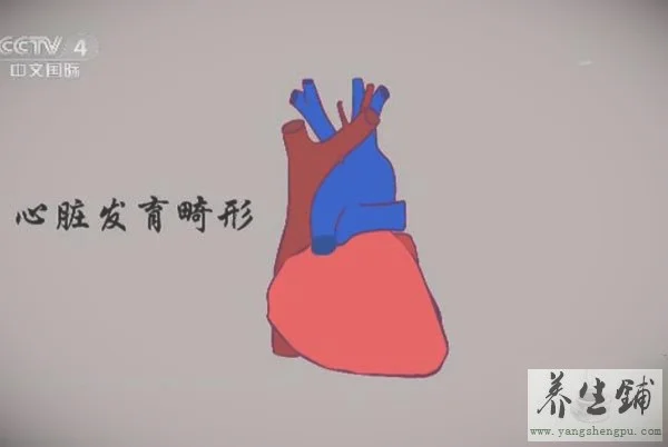 中华医药20170717小儿先天性心脏病