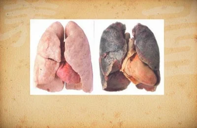 20140420养生堂:肺癌的早期症状与饮食