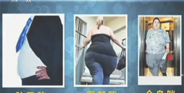 哪种胖更危害_肥胖的类型有几种_图片